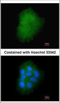 Transmembrane protein 147 Rabbit Polyclonal Antibody
