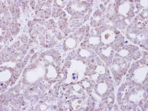 Transmembrane protein 147 Rabbit Polyclonal Antibody