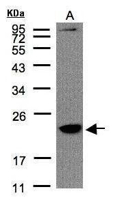Transmembrane protein 147 Rabbit Polyclonal Antibody