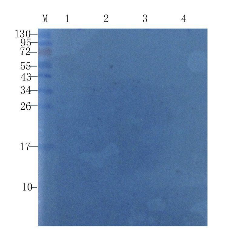 Transthyretin antibody