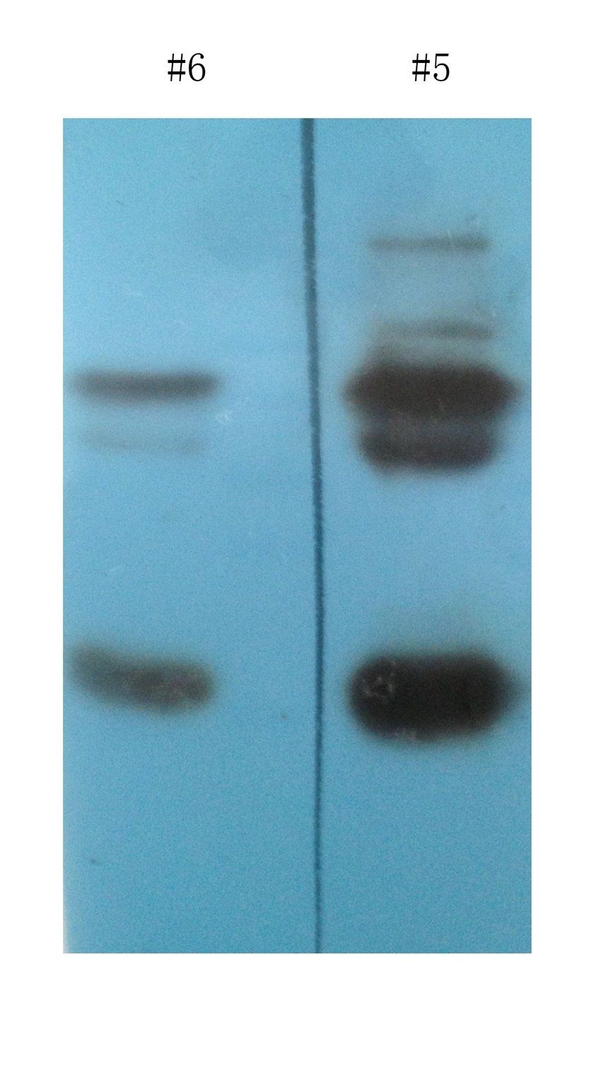 Transthyretin antibody