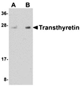 Transthyretin Antibody