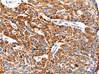 TRAP1 Antibody