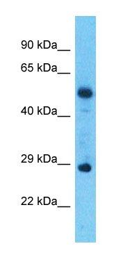 TRAPPC10 antibody