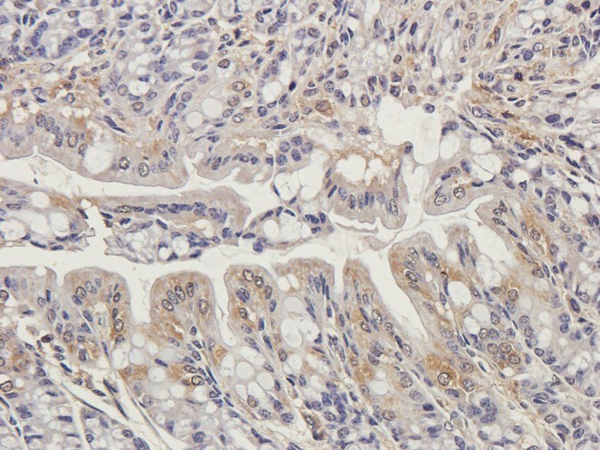 TRAPPC11 Rabbit Polyclonal Antibody