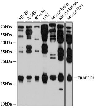 TRAPPC3 antibody