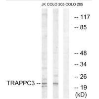 TRAPPC3 antibody