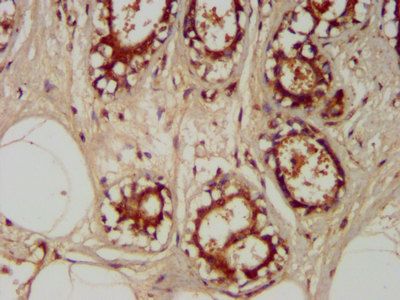 TRAPPC6A Antibody