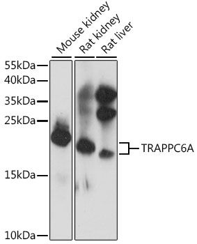 TRAPPC6A antibody