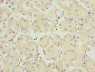 TRAPPC6B Antibody