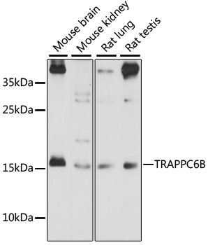 TRAPPC6B antibody