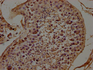 TRAPPC8 Antibody