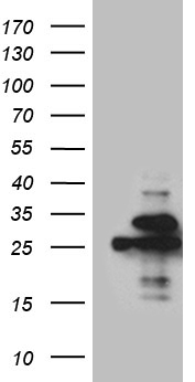 TRBP (TARBP2) antibody