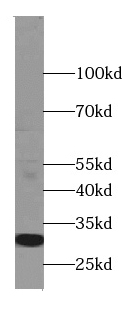 TRBV5-4 antibody