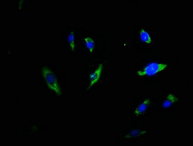 TRDN Antibody