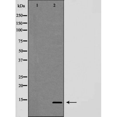 Trefoil factor 2 (phospho-tFF2) antibody