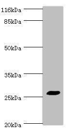 TREM1 antibody