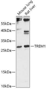 TREM1 antibody