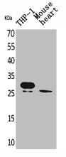 TREM1 antibody