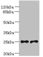 Trem2 antibody