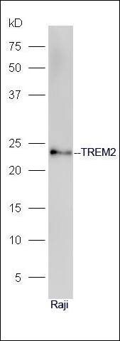 TREM2 antibody
