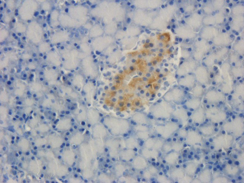TREM2 Rabbit Polyclonal Antibody