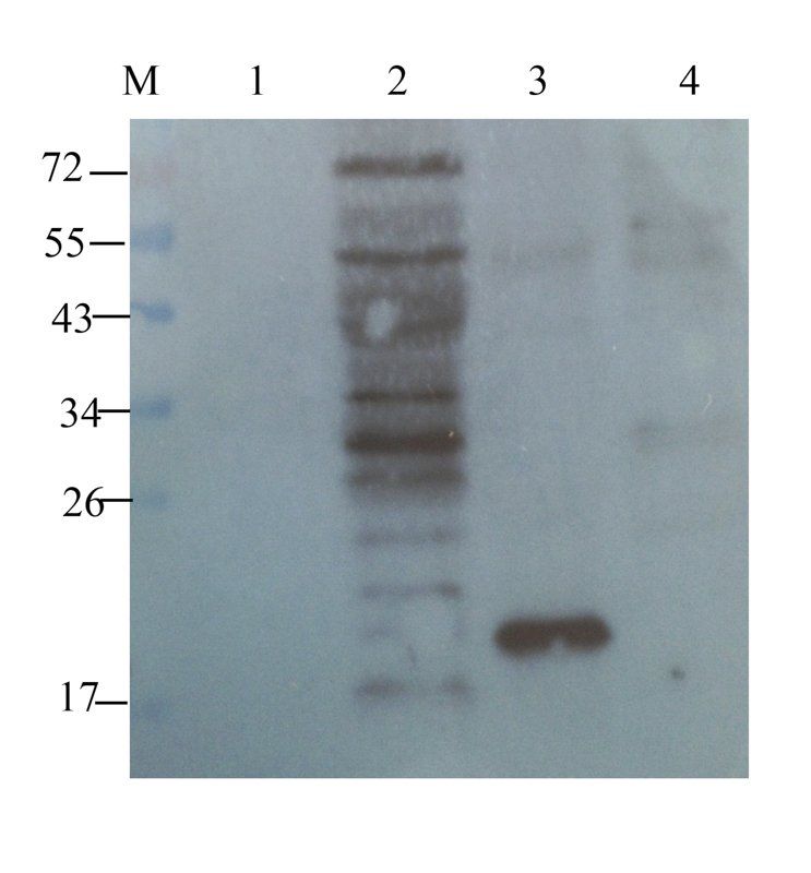 TREM2 antibody