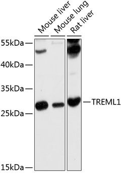 TREML1 antibody