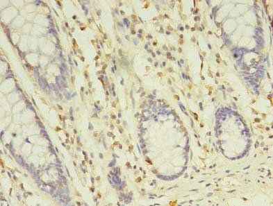 TREML2 Antibody
