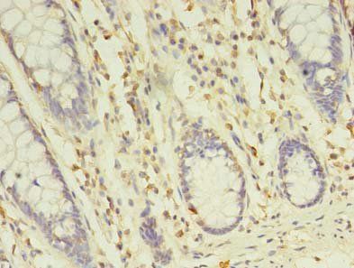 TREML2 antibody