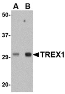 TREX1 Antibody