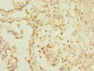 TRHDE Antibody