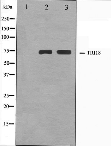 TRI18 antibody