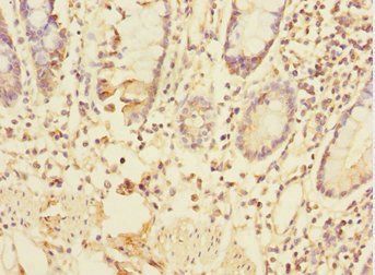 TRIAP1 Antibody