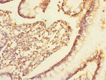 TRIAP1 antibody