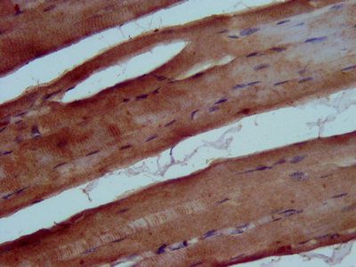 TRIB1 Antibody
