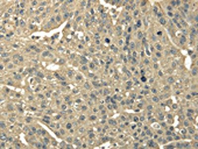 TRIB2 Antibody