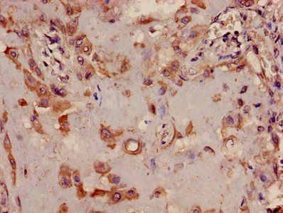TRIB2 Antibody