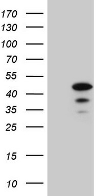 TRIB3 Antibody