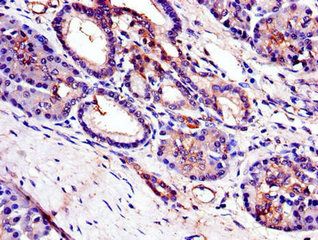 TRIB3 Antibody