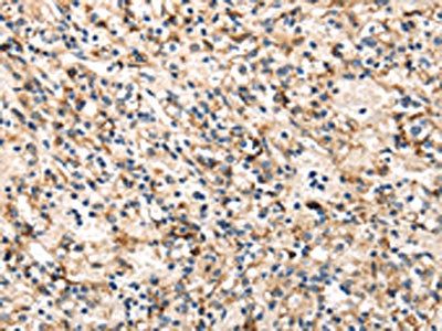 TRIB3 Antibody