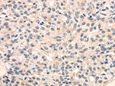 TRIB3 Antibody