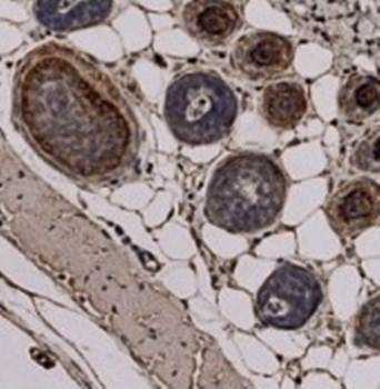 Trichohyalin Monoclonal Antibody [AE15]