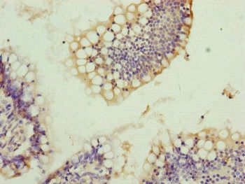 TRIM10 Antibody