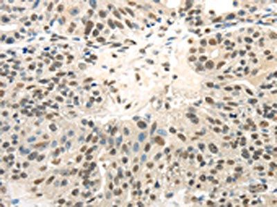 TRIM11 Antibody