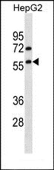 TRIM13 antibody