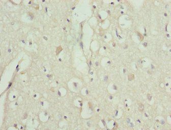 TRIM13 Antibody
