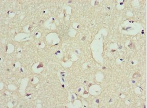 TRIM13 Antibody