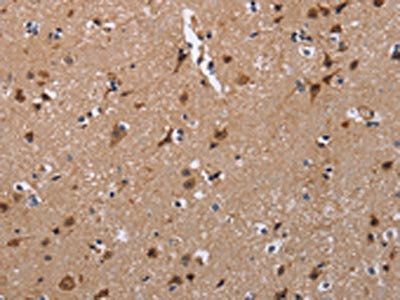 TRIM13 Antibody
