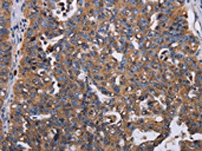TRIM13 Antibody